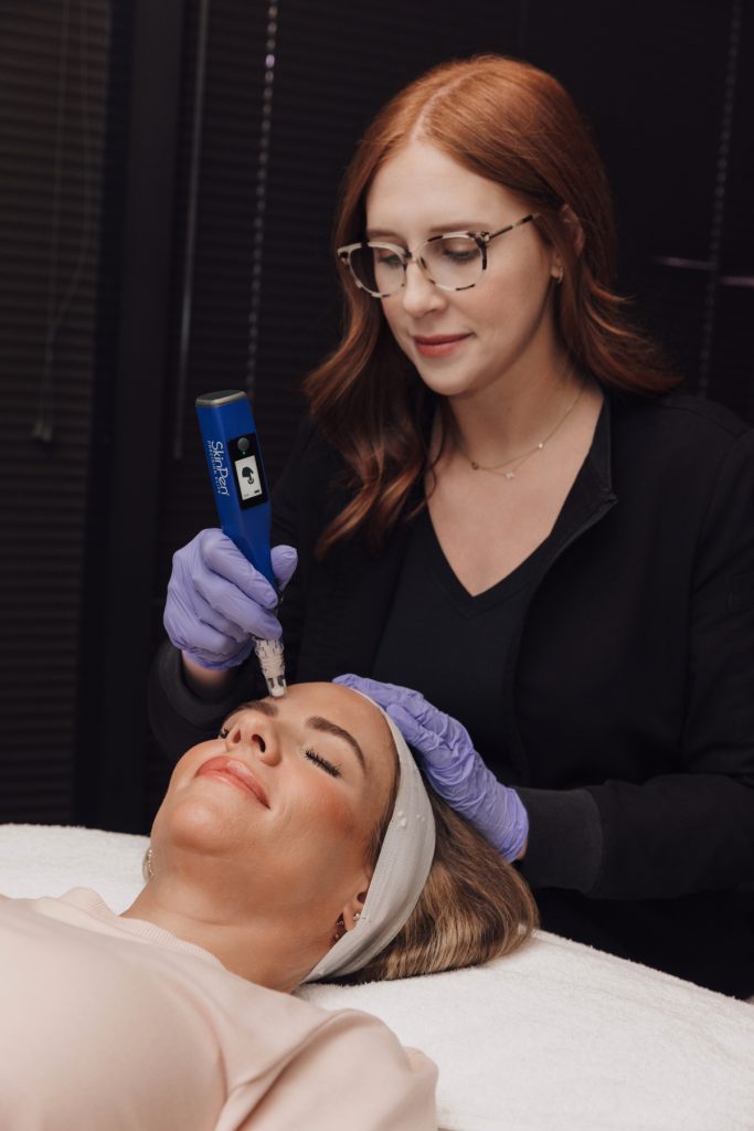 katie w skinpen model