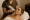 sylfirm x microneedling with rf ongoing
