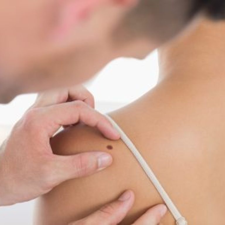 skin cancer tulsa ok skin care institute 450x300 1